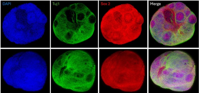 thumbnail Cerebral Organoids 2