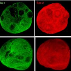 iPSC Organoid Core Facility